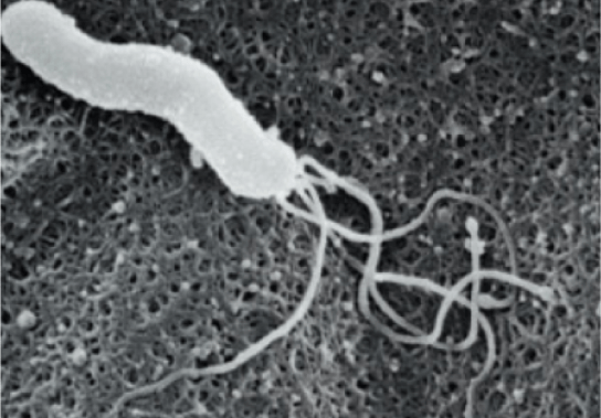 リコバクター・ピロリ(Helicobacter Pylori)